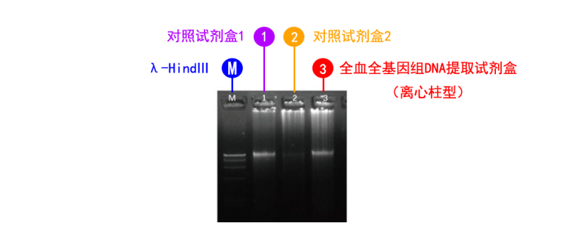 全血全基因组 DNA 提取试剂盒（离心柱型）